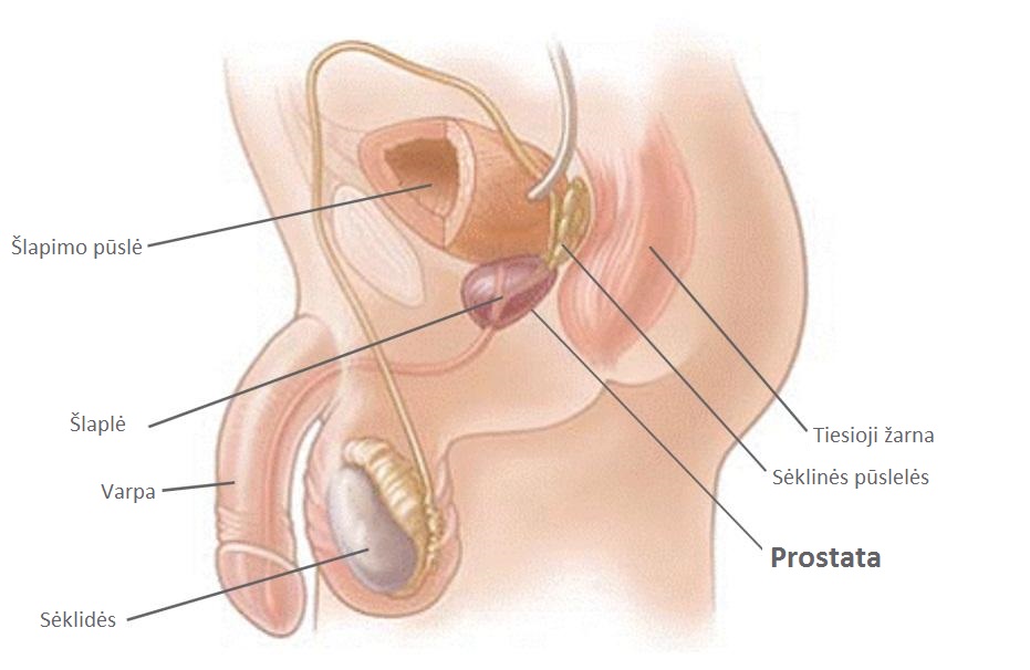 silpnos erekcijos prostatito gydymas padidejo venu varpa